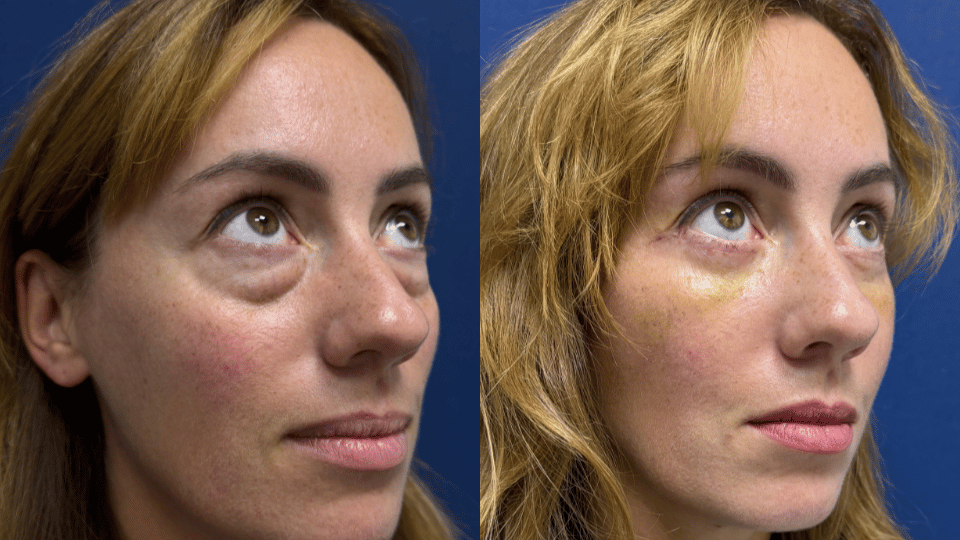 Історія Наді