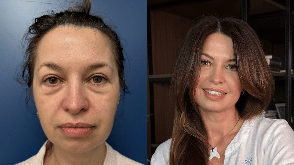 Історія  Лесі